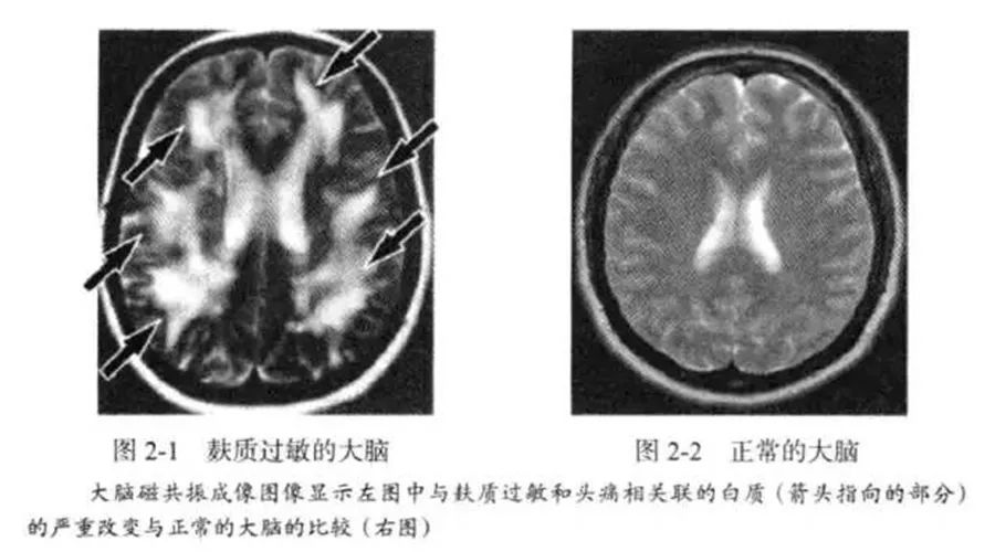 谷物大脑